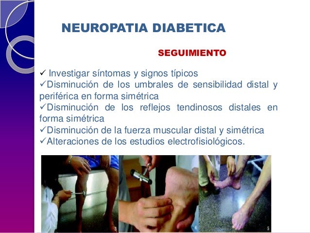 complicaciones de Diabetes Mellitus complicaciones de Diabetes Mellitus