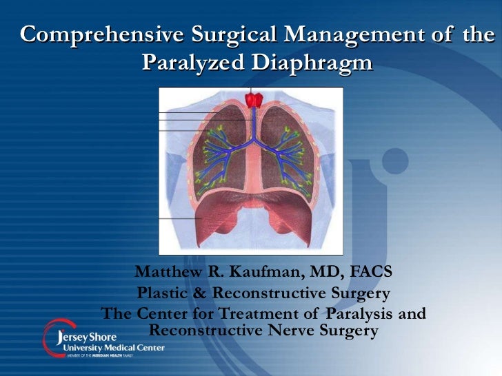 Comprehensive surgical management of the paralyzed diaphragm