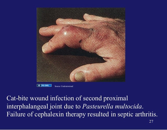 Cephalexin For Dog Bite Cephalexin For Dog Bite