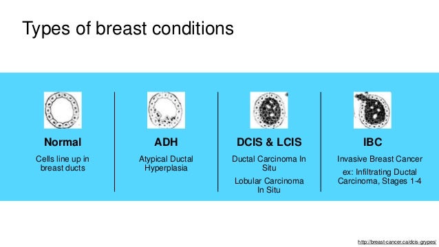 Do You Need An Early Mammogram