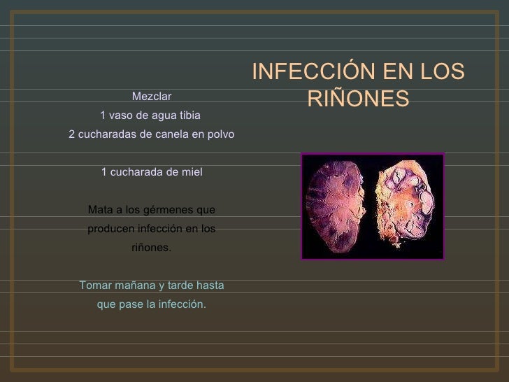 A los niños mrt del departamento de pecho