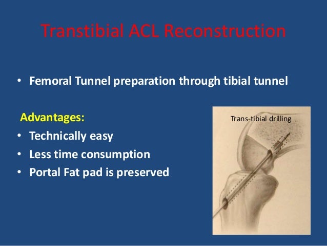 through tunnel doris lessing essays Phy ending words for essays social media in school essay mozart effect research paper report related post of through the tunnel doris lessing essay writing. through tunnel doris lessing essays Phy ending words for essays social media in school essay mozart effect research paper report related post of through the tunnel doris lessing essay writing.