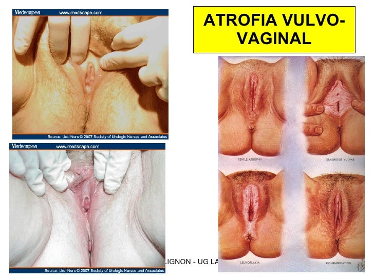Vagina Pic 5