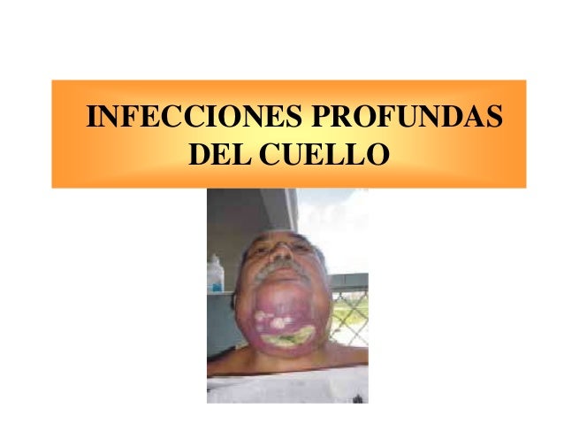 No puedo estar sobre la espalda duele la mano