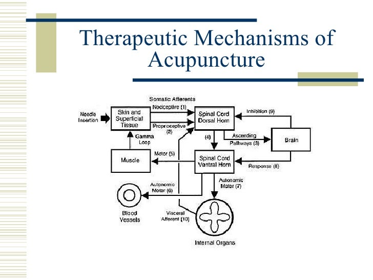 Pain Management by Acupuncture