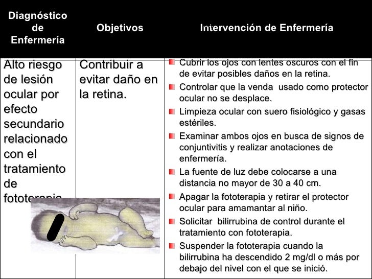 28. ictericia