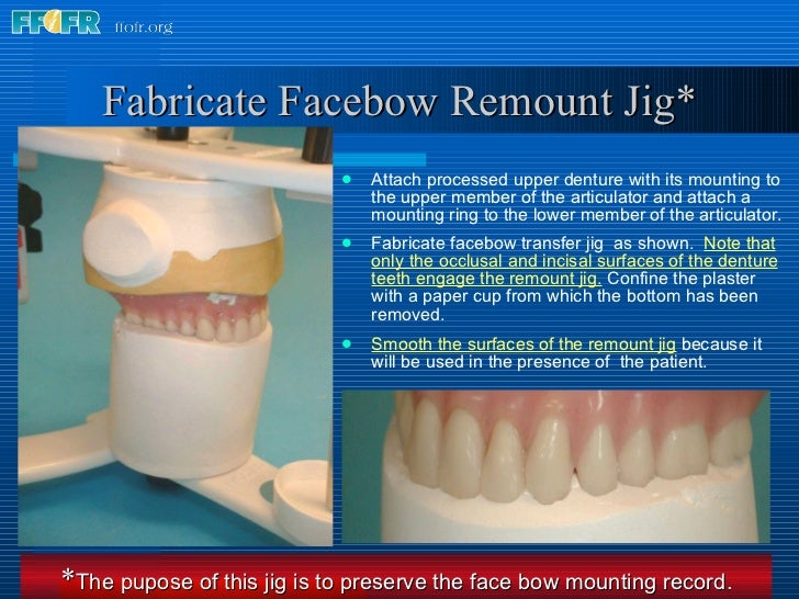 29.preparing dentures for delivery