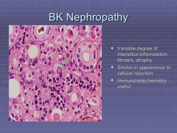 bk diamond cells