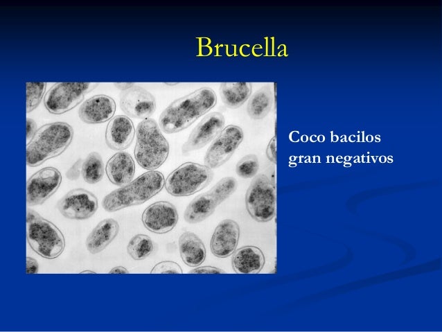 brucella abortus positivo 1 160 brucella abortus positivo 1 160
