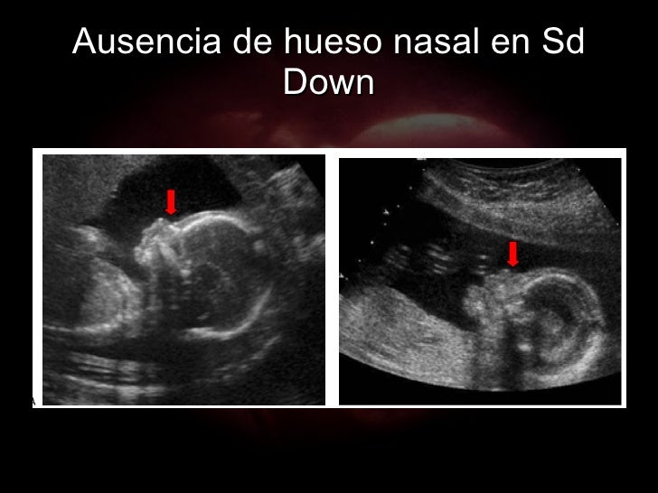 2 El Ultrasonido – Estado Del Arte En Obstetricia 2 El Ultrasonido – Estado Del Arte En Obstetricia