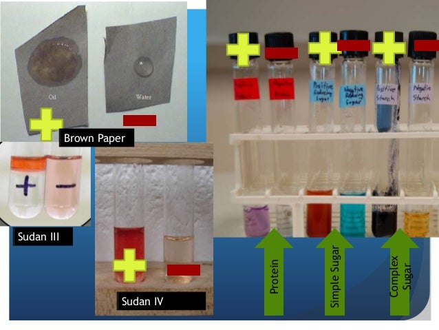 Dische test purpose picture