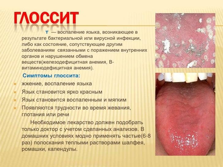 кровоточат десна и запах изо рта лечение кровоточат десна и запах изо рта лечение
