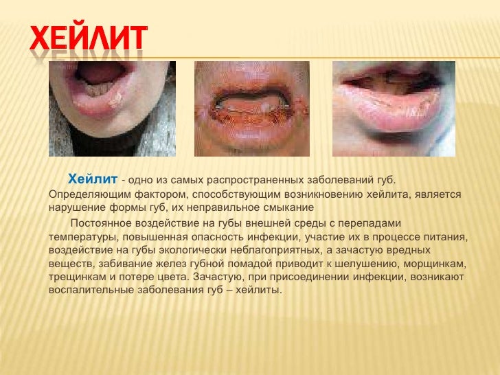 Болят вены на ногах: как справиться с проблемой новые фото Болят вены на ногах: как справиться с проблемой новые фото