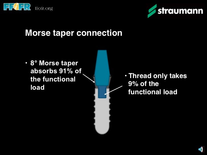 3.implant components and basic techniques3