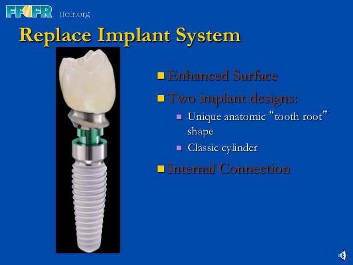 3.implant components and basic techniques3