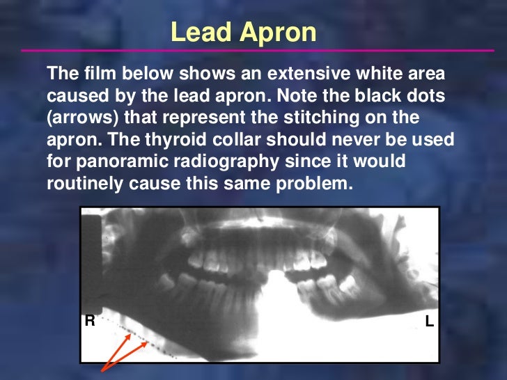 panoramictechique errors
