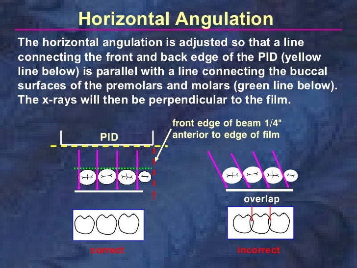 radiographictechniquesbisectingandocclusal