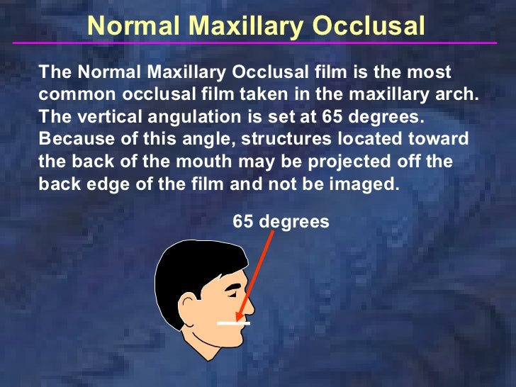 radiographictechniquesbisectingandocclusal