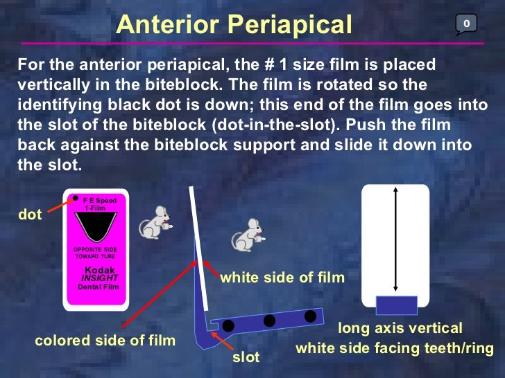radiologyparallelingtechnique