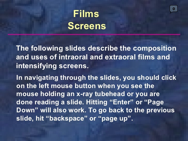 radiology x ray film screens paralleling technique