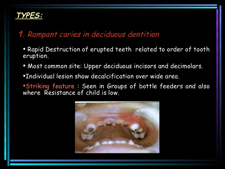 rampant caries
