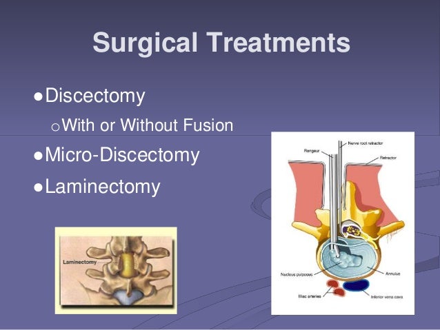 Cervical Radiculopathy Power Point.ppt