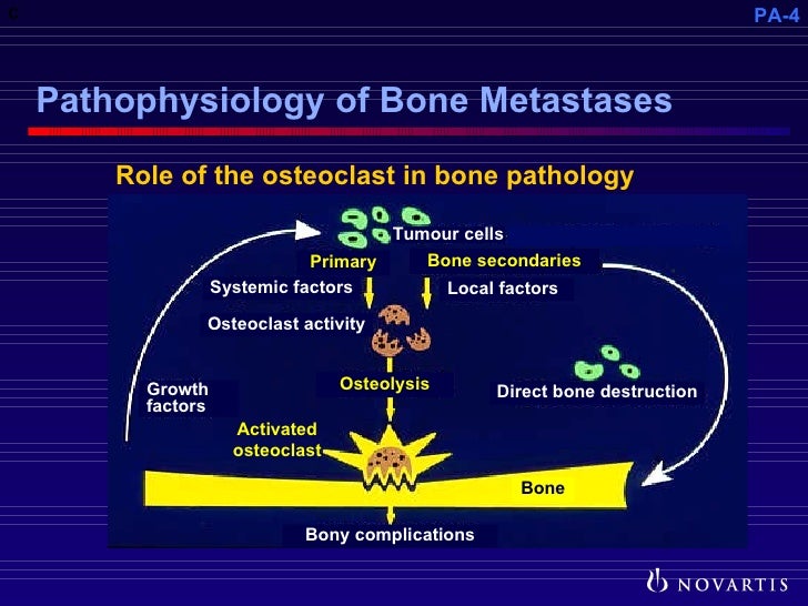 Pathophysiology of Metastatic Bone Disease and the Role of Bisphosp…