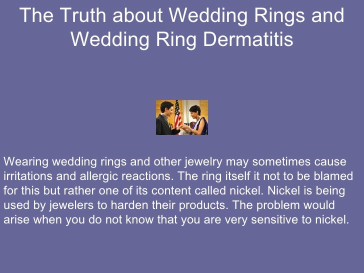 wedding ring dermatitis