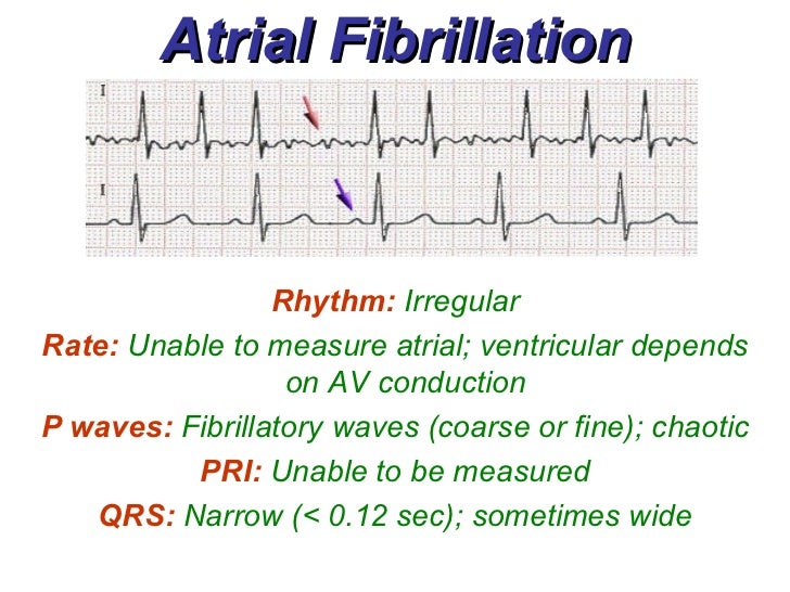 how to control afib rvr