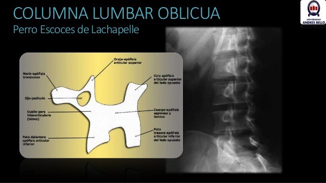 Que el ungüento calma mejor el dolor en la espalda
