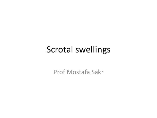 3 Scrotal Swellings