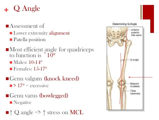 anterior cruciate ligament sprain remedy