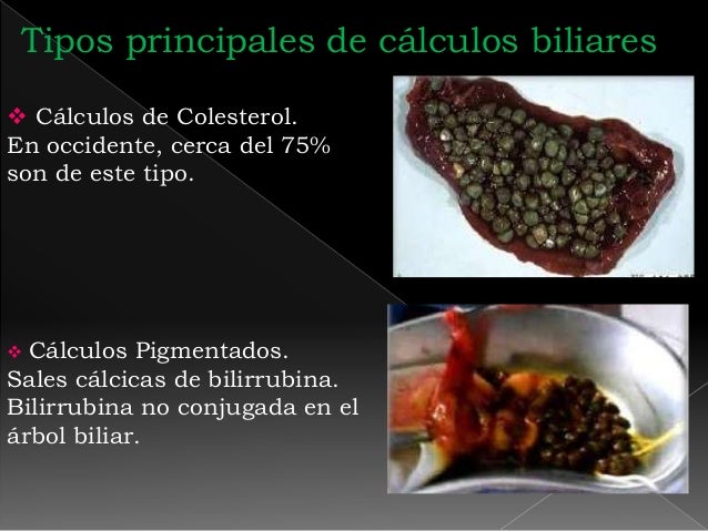 Clase de vesicula y vias biliares - Ecografia