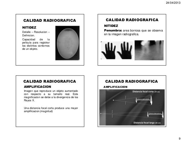 4. imagen radiografica. formacion. calidad