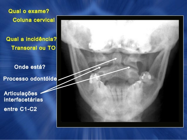 Exame c4