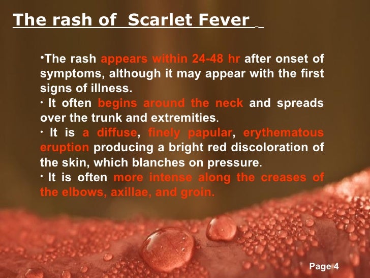 Post Kawasaki Disease Post Kawasaki Disease