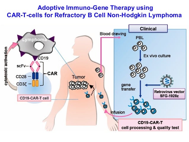 CART cells in Leukemia. Prof. Keiya Ozawa