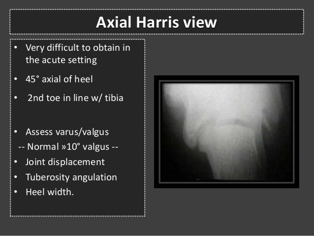 long leg calcaneal axial view