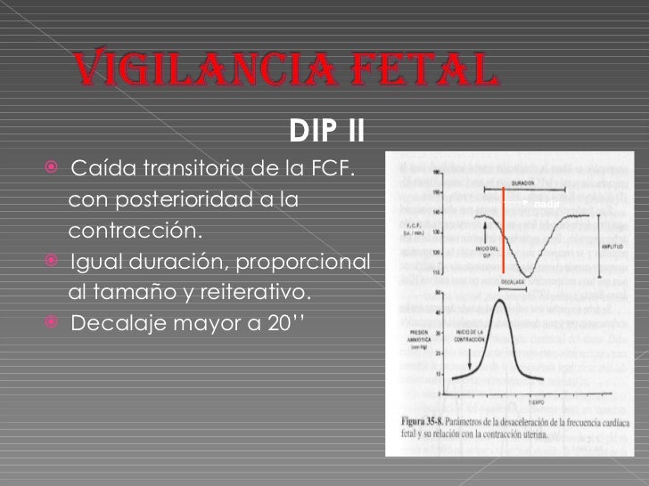 5. monitoreo fetal durante trabajo de parto
