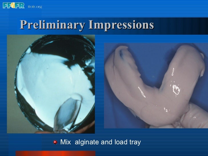 5.preliminary impressions