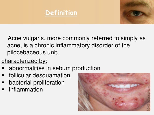 acne vulgaris