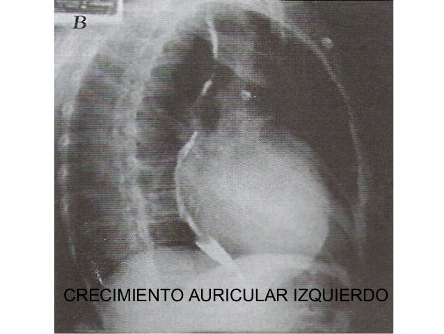 5 radiologia serie cardiaca