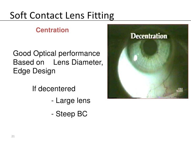 Soft Contact Lens Fitting