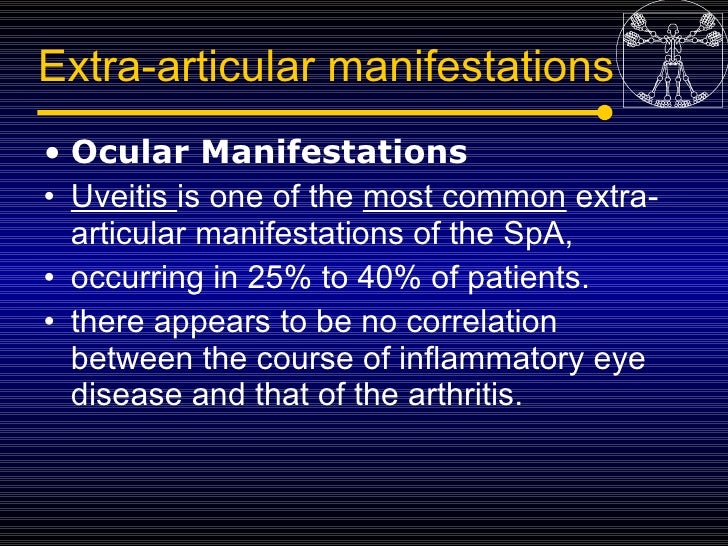 Rheumatoid Arthritis IvyLeagueNurse Unlimited Nurse CEUs