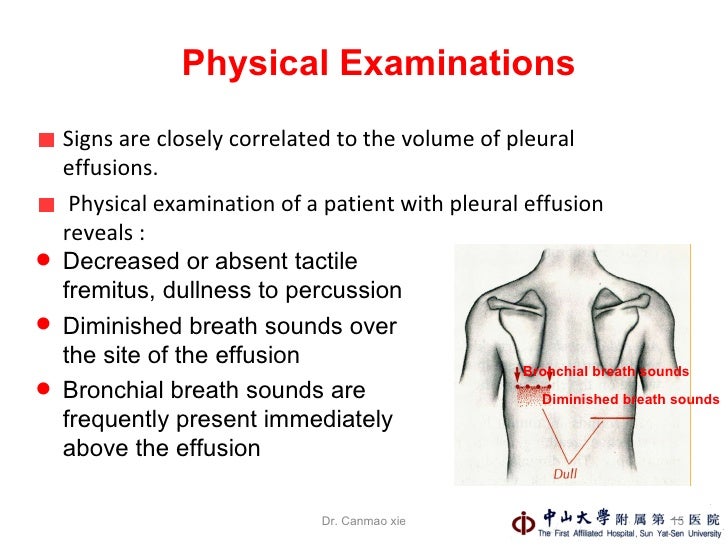 6.Pleural Effusions
