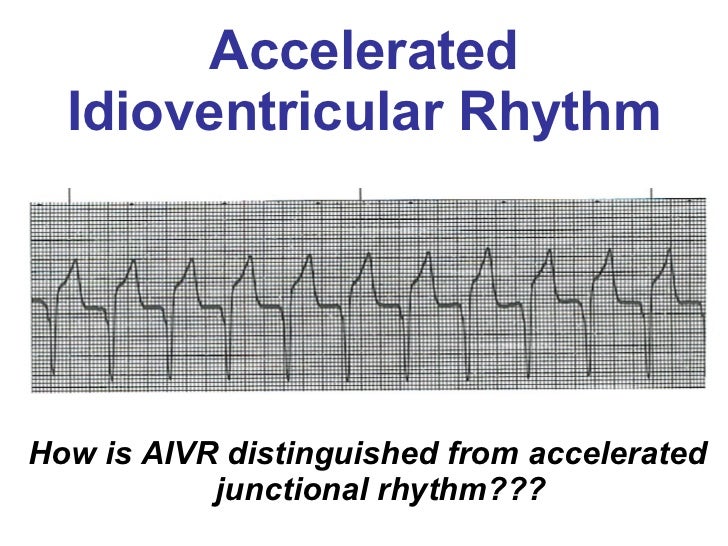 Ventricular Rhythms BMH/Tele