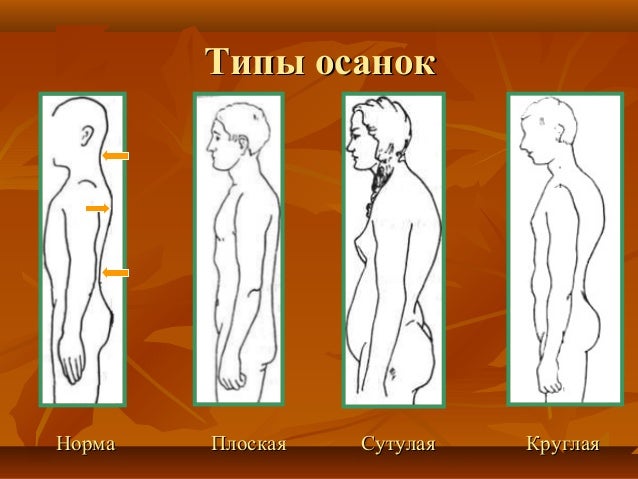 грудной кифоз 2 степени породы маленьких собак