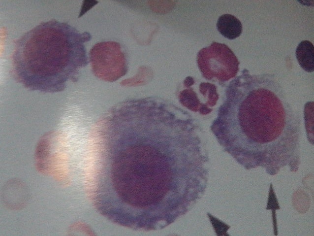 CSF Cell Count Bing