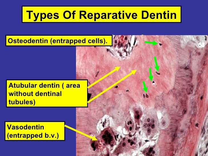 7 dentinogenesis