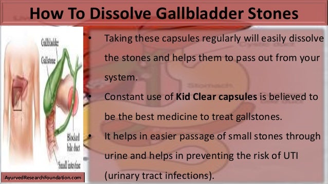 How To Dissolve Gallbladder Stones Naturally How To Dissolve Gallbladder Stones Naturally